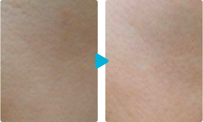 Female in her 50s 1 time