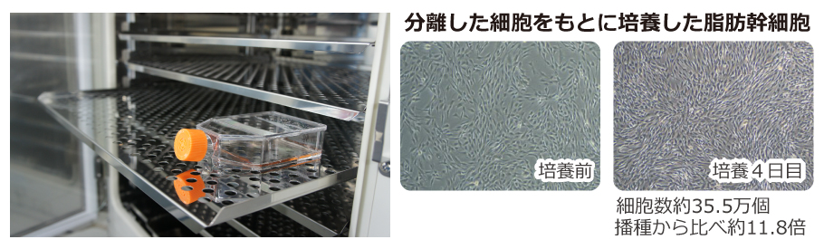 細胞培養土による細胞処理・CPCの様子