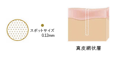 スポットサイズ 0.12mm 真皮網状層