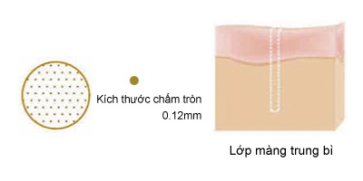 Kích thước chấm tròn 0,12mm Lớp màng trung bì