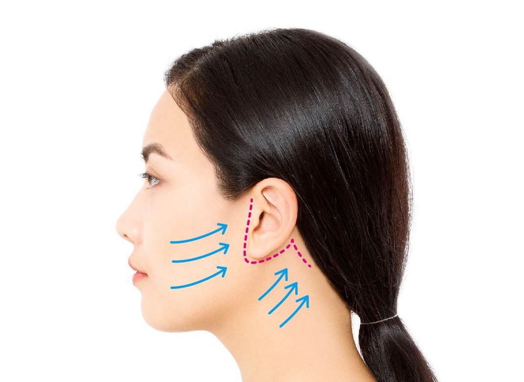 フェイス＆ネックリフトイメージイラスト